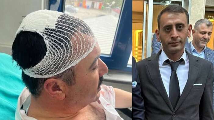 YRP'li siyasetçi, Dulkadiroğlu Belediye başkanı yardımcısının şekerlikle kafasını yardı