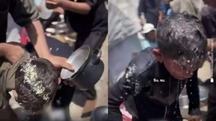 Yürek yakan anlar... Gazze'de ailesine yemek götürmek isteyen çocuk yandı