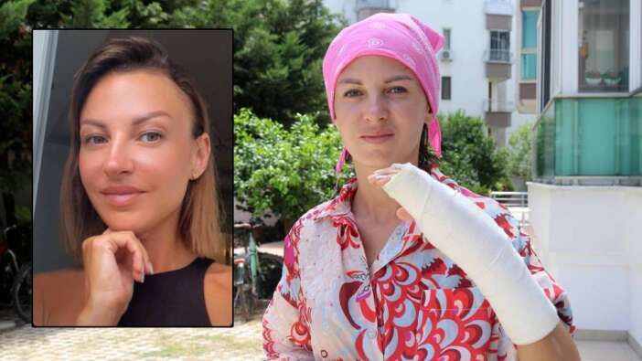 Ukraynalı eski eşi Irina'ya sopayla saldırdı, hastanelik etti! "Öldüreceğim" diyerek defalarca vurdu