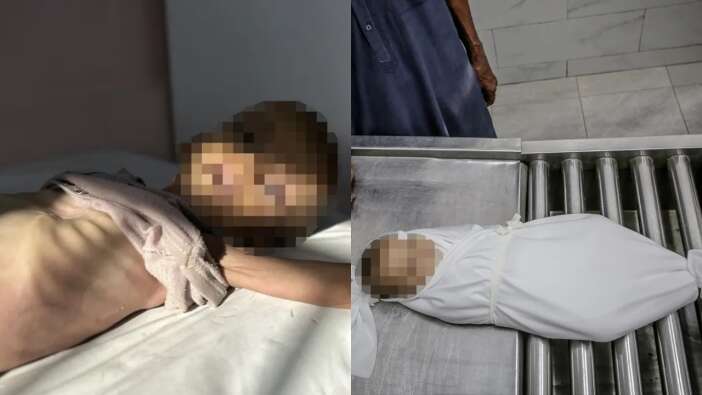 Gazze'de soykırım var! 11 kişi açlıktan hayatını kaybetti