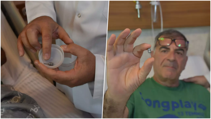 Öksürük şikayetiyle gittiği hastanede duyduklarına inanamadı! Akciğerinden diş implantı çıktı