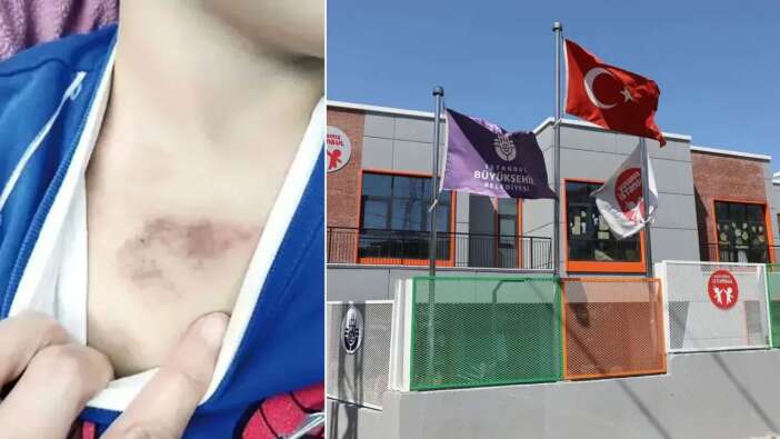 İBB suçluları mı koruyor? 3 yaşında çocuğa şiddet olayında gerçeklerin üzeri örtülüyor