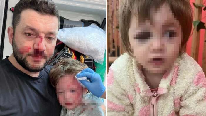 Türkiye, Yalova'daki komşu dehşetini konuşuyor! 14 aylık bebeği ve babasını sopayla darbetti! Bakan Gürlek duruma el koydu: Süreç titizlikle takip ediliyor!