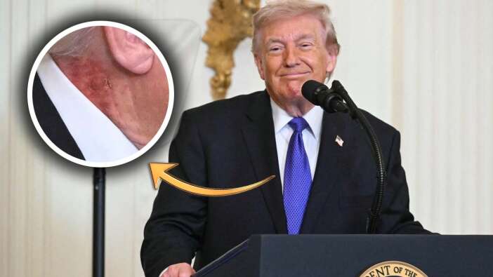 Sosyal medya bu görüntüyü konuşuyor! Trump'ın boynundaki yara izinin sırrı ne?
