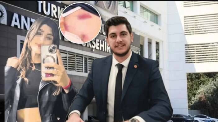 Antalya Büyükşehir Belediyesi'nde şok iddia: Meclis üyesi Taylan Şanlı, genç kadına korku dolu anlar yaşattı!
