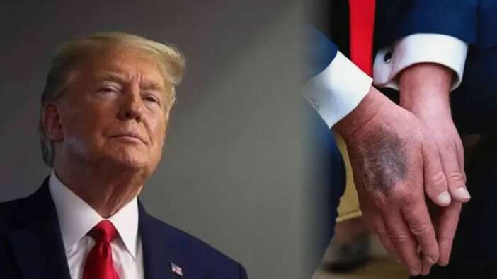 ABD Başkanı Trump bizzat kendisi açıkladı: Sağlık taramasına girdi