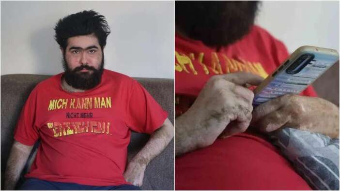 3 aylık tedaviden sonra Barış Özbay'ın ilk işi bakın ne oldu! "Ben artık iflah olmam"