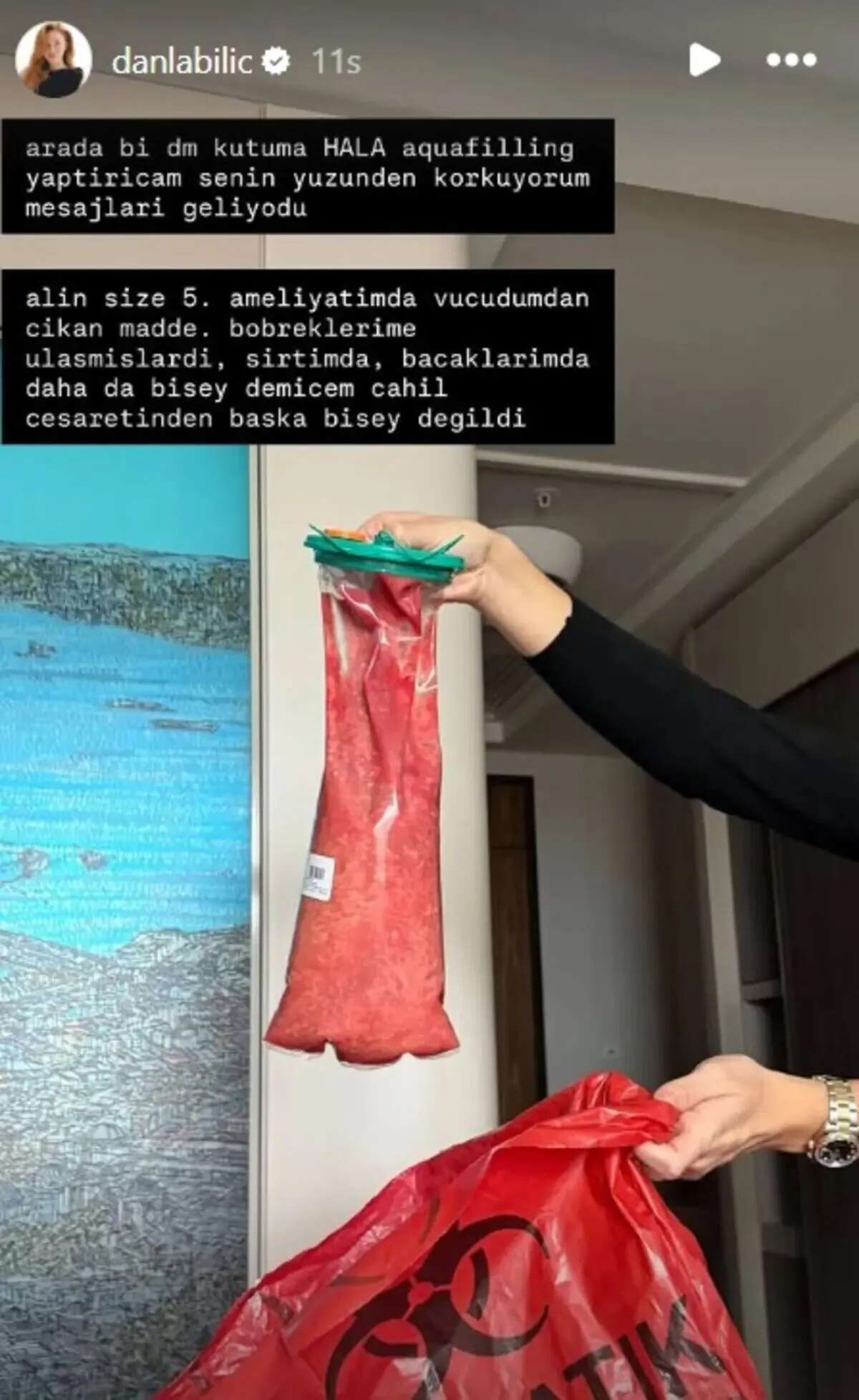 vbhjk